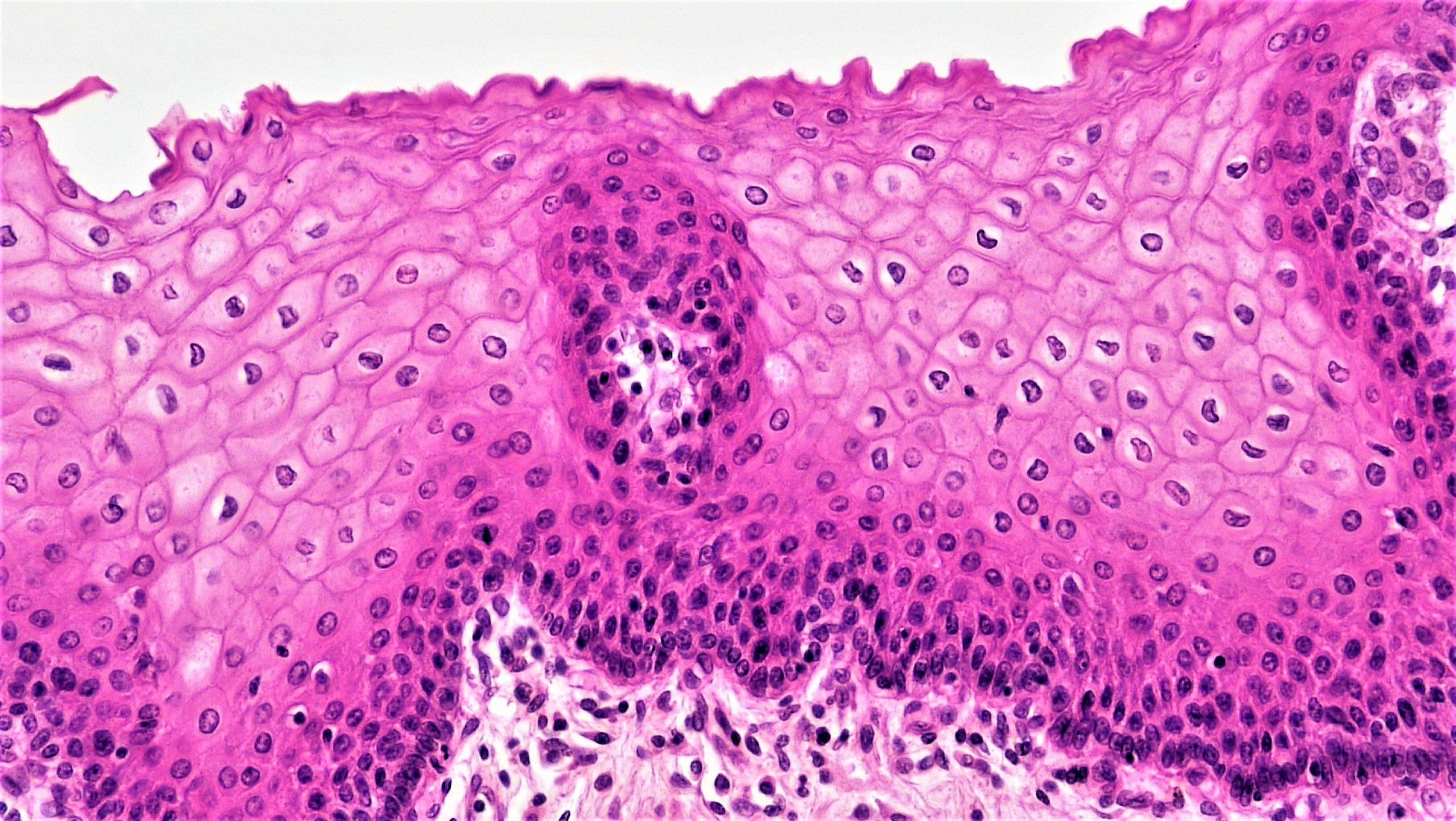 Read more about the article Histology (Epithelial Tissue)